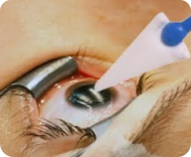 Ophthalmic & Accessories