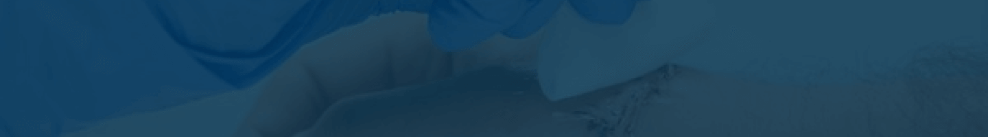 Wound Cleansing Wound Cleansing