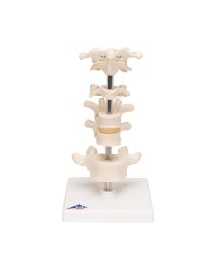 Mounted Vertebrae Model (6 part) [Pack of 1]