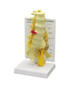 Lumbar Spine Model with Sacrum [Pack of 1]