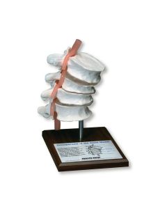 Osteoporosis Of The Spine Model [Pack of 1]