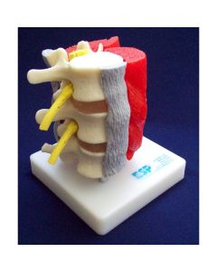 Lumbar Vertebrae With Muscles Model [Pack of 1]