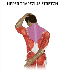 Upper Trapezius Stretch Chart / Poster - Laminated [Pack of 1]