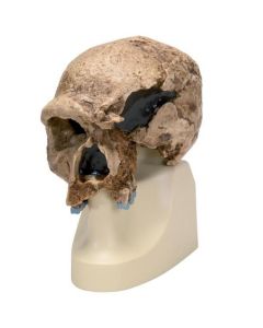 Steinheim Anthropological Skull Model [Pack of 1]