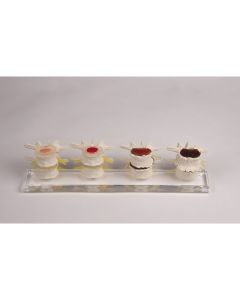 Stages of Disc Degeneration Model [Pack of 1]