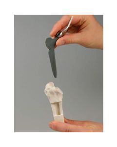 Hip Implant / Replacement Model Set (3 part) [Pack of 1]