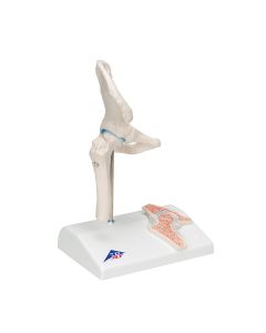 Mini Hip Joint Model with Cross-Section [Pack of 1]