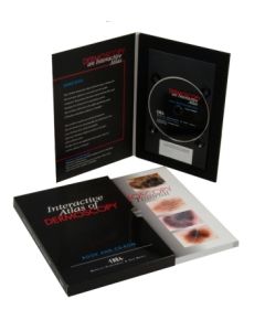 Schuco Interactive Atlas Of Dermoscopy [Pack of 1]