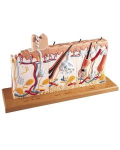 Human Skin Series with Burn Pathologies (75 times life size) [Pack of 1]