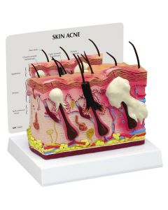 Normal / Acne Skin Model [Pack of 1]