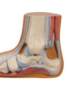 Normal Foot Model [Pack of 1]