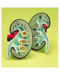 Urine Secretion Model [Pack of 1]