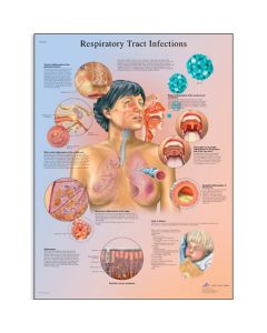 Respiratory Tract Infections Laminated Chart / Poster [Pack of 1]