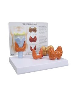 Thyroid Disease Model [Pack of 1]
