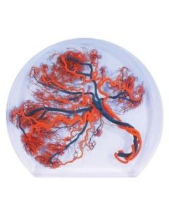 Coloured Model of Placenta [Pack of 1]