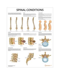 Spinal Conditions Chart / Poster - Laminated [Pack of 1]
