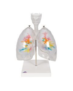 CT Bronchial Tree with Larynx and Transparent Lung Model [Pack of 1]