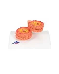 COPD Model [Pack of 1]