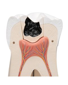 Upper Triple-Root Molar Tooth Model (3 part) [Pack of 1]