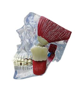 TMJ Disorder Model [Pack of 1]