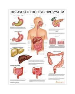Diseases of the Digestive System Chart / Poster - Laminated [Pack of 1]