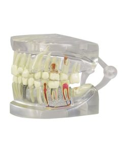 Transparent Jaw with Teeth Model [Pack of 1]