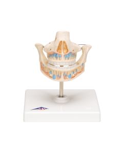 Milk Dentures Model [Pack of 1]