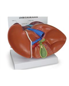 Liver and Gallbladder Model with Gallstones [Pack of 1]