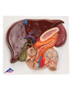 Liver Model with Gall Bladder, Pancreas and Duodenum [Pack of 1]