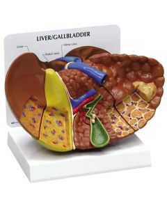 Liver Model with Pathologies [Pack of 1]