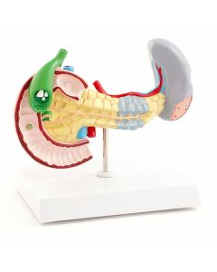 Pancreatic Diseases Model [Pack of 1]