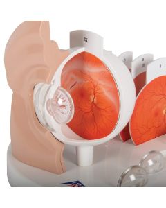 Pathological Eye Model [Pack of 1]