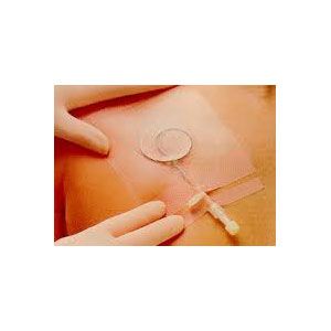 IV3000 Central Line Catheter Dressing 10cm x 12cm Dressing Pack of 10 | AHP Medicals IV3000 Central Line Catheter Dressing 10cm x 12cm Dressing Pack of 10 | AHP Medicals