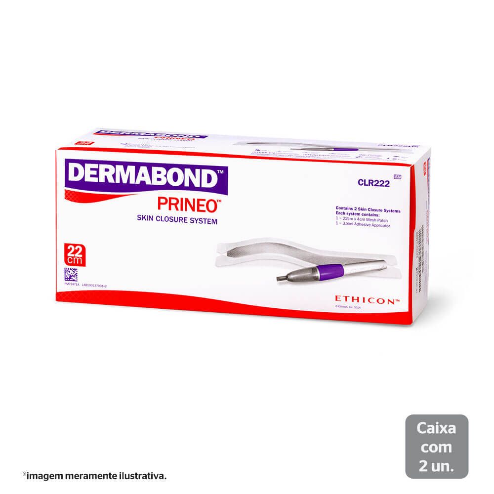 Buy Ethicon DERMABOND PRINEO Skin Closure System (22 cm), CLR222US
