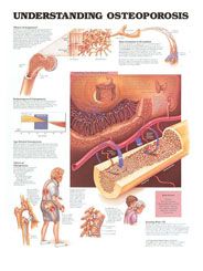 Anatomical Chart Understanding Osteoporosis