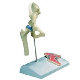 Miniature Hip Joint, on stand