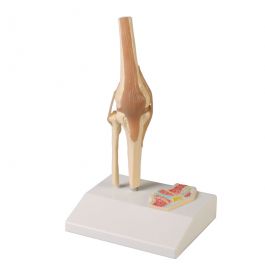 Erler Zimmer Miniature Knee Joint On Stand [Pack of 1]