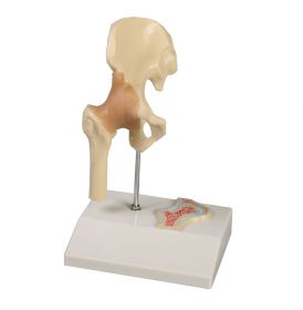 Erler Zimmer Miniature Hip Joint On Stand [Pack of 1]