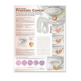 Anatomical Chart - Understanding Prostate Cancer