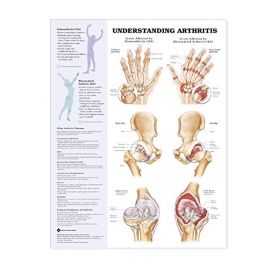 Anatomical Chart - Understanding Arthritis