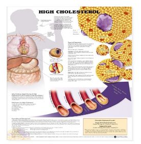 Anatomical Chart - High Cholesterol