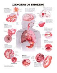Anatomical Chart Dangers of Smoking