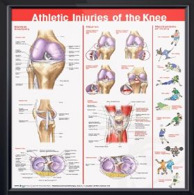 Anatomical Chart - Athletic Injuries of the Knee