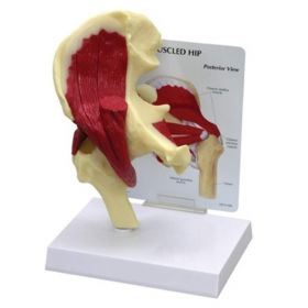 Hip Anatomy & Pathology Collection [Pack of 1]