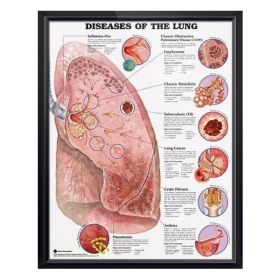 Anatomical Chart - Diseases of the Lung