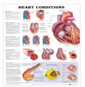 Anatomical Chart - Heart Conditions