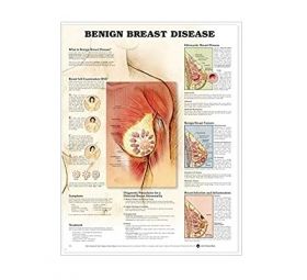 Anatomical Chart - Benign Breast Disease