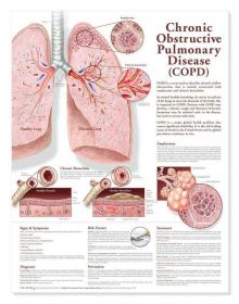 Anatomical Chart - Chronic Obstructive Pulmonary Disease (COPD), 2nd Edition