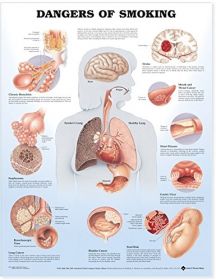 Anatomical Chart - Dangers of Smoking