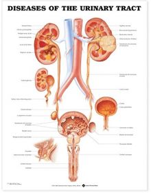 Anatomical Chart - Diseases of the Urinary Tract